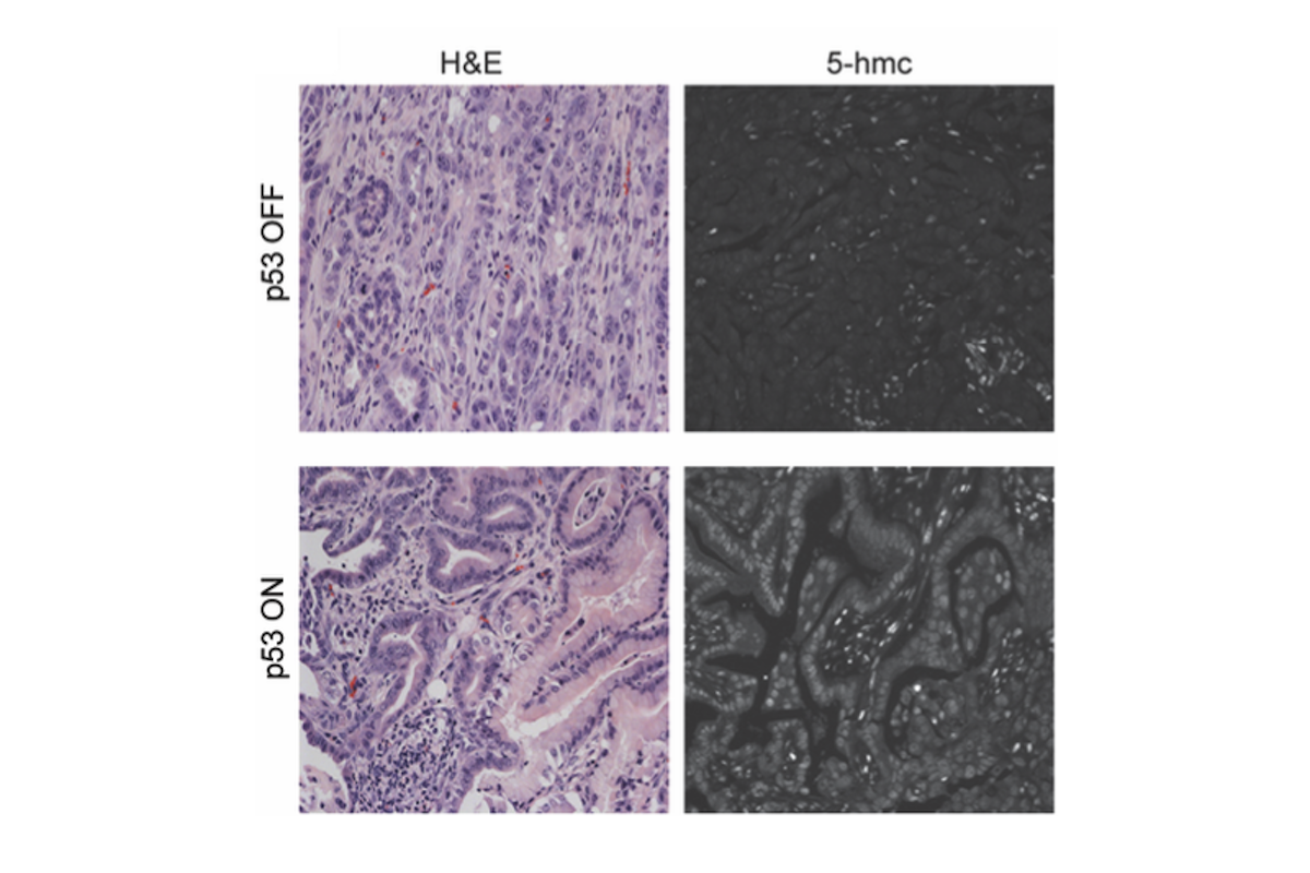 p53 restoration restores alpha-ketoglutarate dependent features of pre-malignant differentiation in mouse pancreatic cancer in vivo.