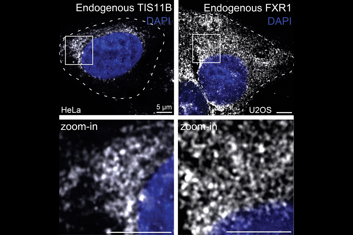 My laboratory studies the regulatory and structural roles of mRNAs in the cytoplasm.